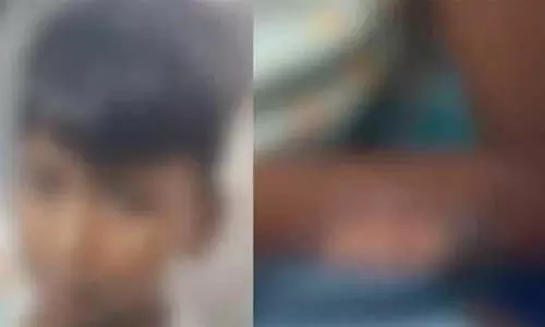 ഇടുക്കി കുമളിയില് ഏഴ് വയസ്സുകാരനെ മാതാവ് പൊള്ളലേല്പ്പിച്ചു ഇടുക്കി കുമളിയില് ഏഴ് വയസ്സുകാരനെ മാതാവ് പൊള്ളലേല്പ്പിച്ചു