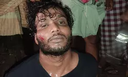 മോഷണ കുറ്റമാരോപിച്ച് യുവാവിന് ക്രൂര മർദ്ദനം