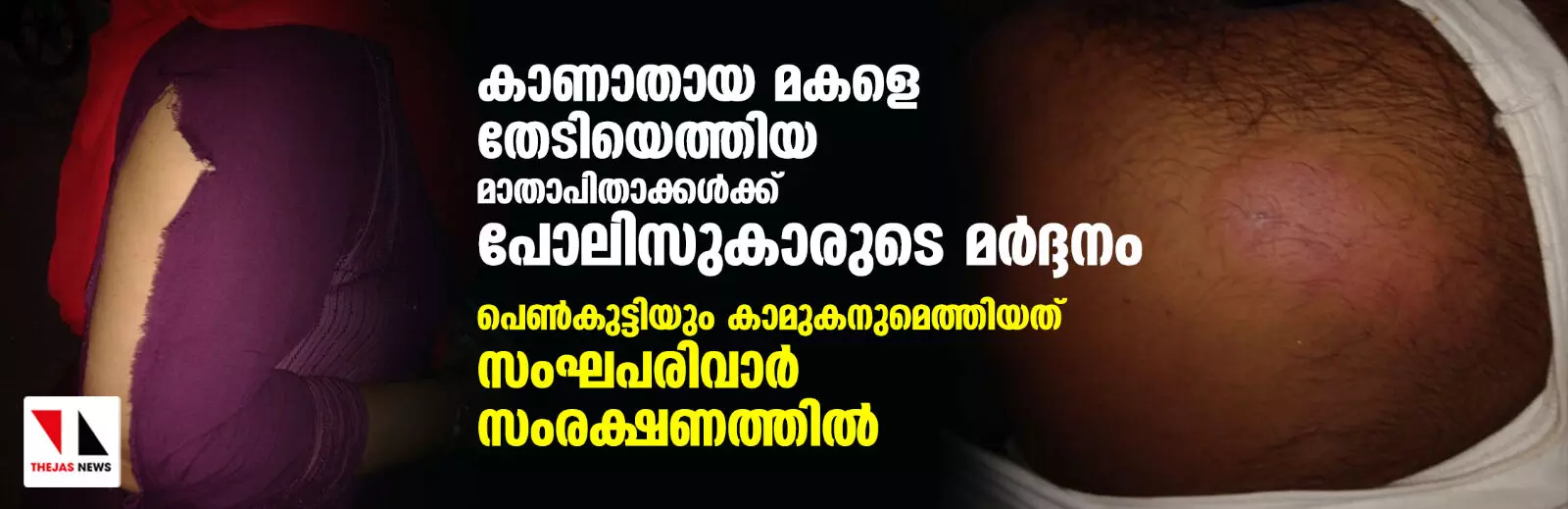 കാണാതായ മകളെ തേടിയെത്തിയ മാതാപിതാക്കള്‍ക്ക് പോലിസുകാരുടെ മര്‍ദ്ദനം