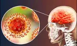നിപ: വയനാട്ടിലും ജാഗ്രതാ നിര്ദ്ദേശം; മാസ്ക് നിര്ബന്ധമാക്കി; നിരീക്ഷണം തുടരും നിപ: വയനാട്ടിലും ജാഗ്രതാ നിര്ദ്ദേശം; മാസ്ക് നിര്ബന്ധമാക്കി; നിരീക്ഷണം തുടരും