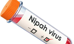 പുതിയ നിപ കേസുകളില്ല; സമ്പര്ക്കപ്പട്ടികയില് 1233 പേര് പുതിയ നിപ കേസുകളില്ല; സമ്പര്ക്കപ്പട്ടികയില് 1233 പേര്