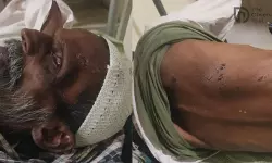 ജയ് ശ്രീറാം വിളിക്കാന്‍ ആവശ്യപ്പെട്ട് കാഴ്ച പരിമിതിയുള്ള മുസ് ലിം വയോധികന് ക്രൂരമര്‍ദ്ദനം; താടിക്ക് തീവച്ചു(വീഡിയോ)