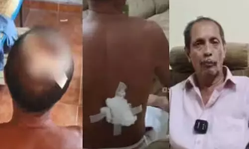 ക്ഷേത്രവാദ്യത്തില് ശബ്ദം കുറഞ്ഞെന്ന് ആരോപിച്ച് മര്ദ്ദിച്ചെന്ന് ക്ഷേത്ര ജീവനക്കാരന്റെ പരാതി ക്ഷേത്രവാദ്യത്തില് ശബ്ദം കുറഞ്ഞെന്ന് ആരോപിച്ച് മര്ദ്ദിച്ചെന്ന് ക്ഷേത്ര ജീവനക്കാരന്റെ പരാതി