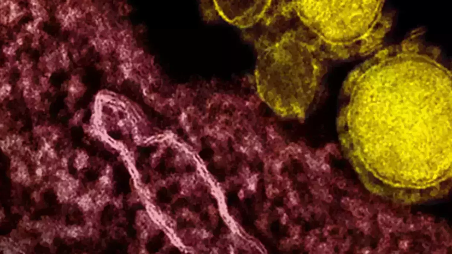 സൗദിയില്‍ വീണ്ടും മെര്‍സ് രോഗം; രണ്ടു പേര്‍ മരിച്ചു