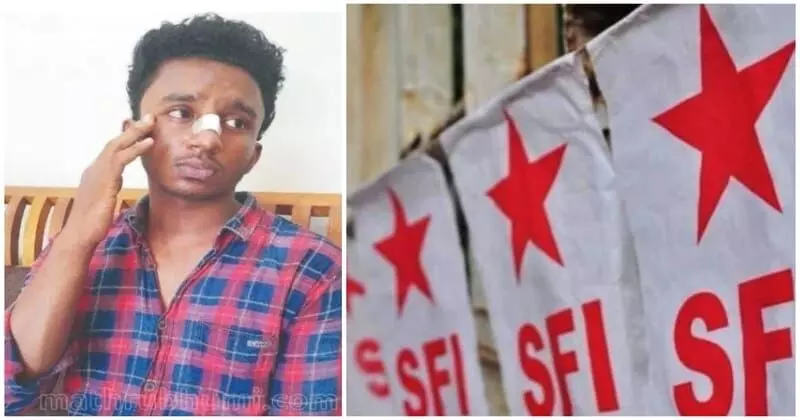 എസ് എന് ഡി പി കോളജില് വിദ്യാര്ഥിയെ മര്ദിച്ച സംഭവം: എസ് എഫ് ഐ യൂണിറ്റ് സെക്രട്ടറിയടക്കമുള്ളവര്ക്ക് സസ്പെന്ഷന് എസ് എന് ഡി പി കോളജില് വിദ്യാര്ഥിയെ മര്ദിച്ച സംഭവം: എസ് എഫ് ഐ യൂണിറ്റ് സെക്രട്ടറിയടക്കമുള്ളവര്ക്ക് സസ്പെന്ഷന്