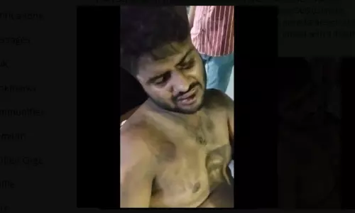 യുപിയില് മുസ് ലിം ഡോക്ടറെ പേരുചോദിച്ച് ക്രൂരമായി മര്ദ്ദിച്ചു യുപിയില് മുസ് ലിം ഡോക്ടറെ പേരുചോദിച്ച് ക്രൂരമായി മര്ദ്ദിച്ചു