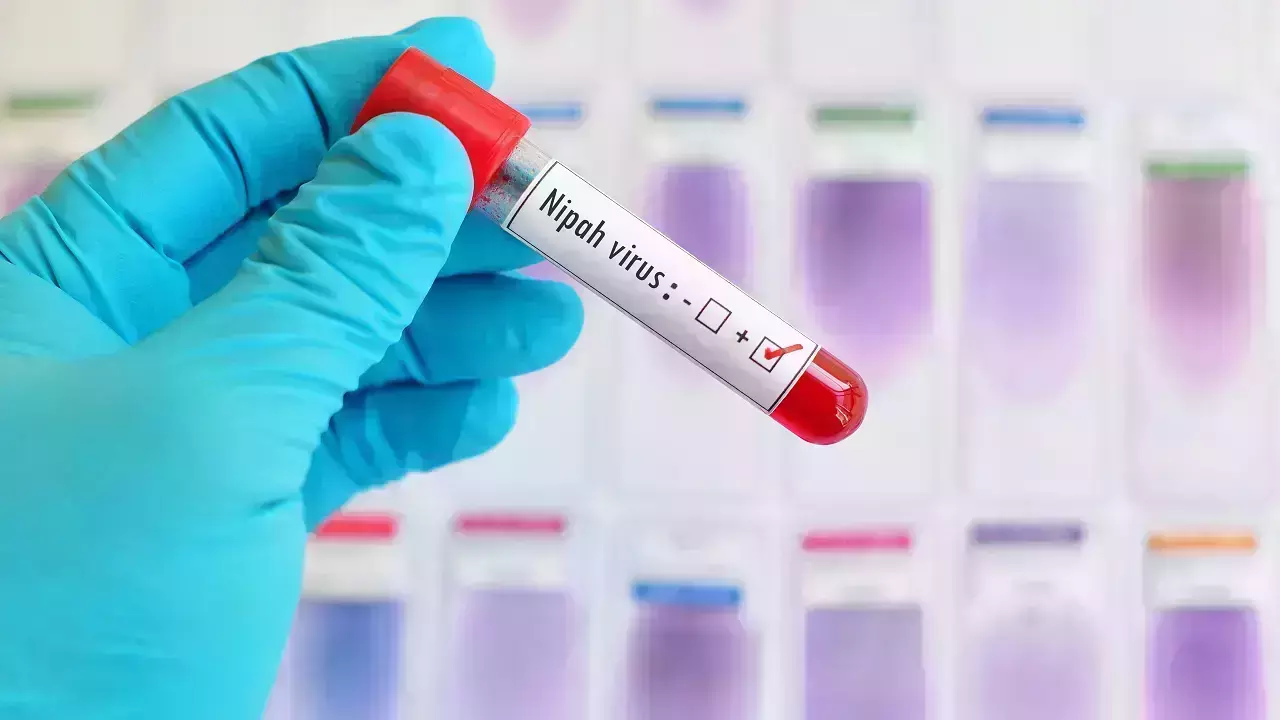 നിപയില് ആശ്വാസം: ഏഴു പേരുടെ പരിശോധനാ ഫലം നെഗറ്റീവ്: മന്ത്രി വീണാ ജോര്ജ് നിപയില് ആശ്വാസം: ഏഴു പേരുടെ പരിശോധനാ ഫലം നെഗറ്റീവ്: മന്ത്രി വീണാ ജോര്ജ്
