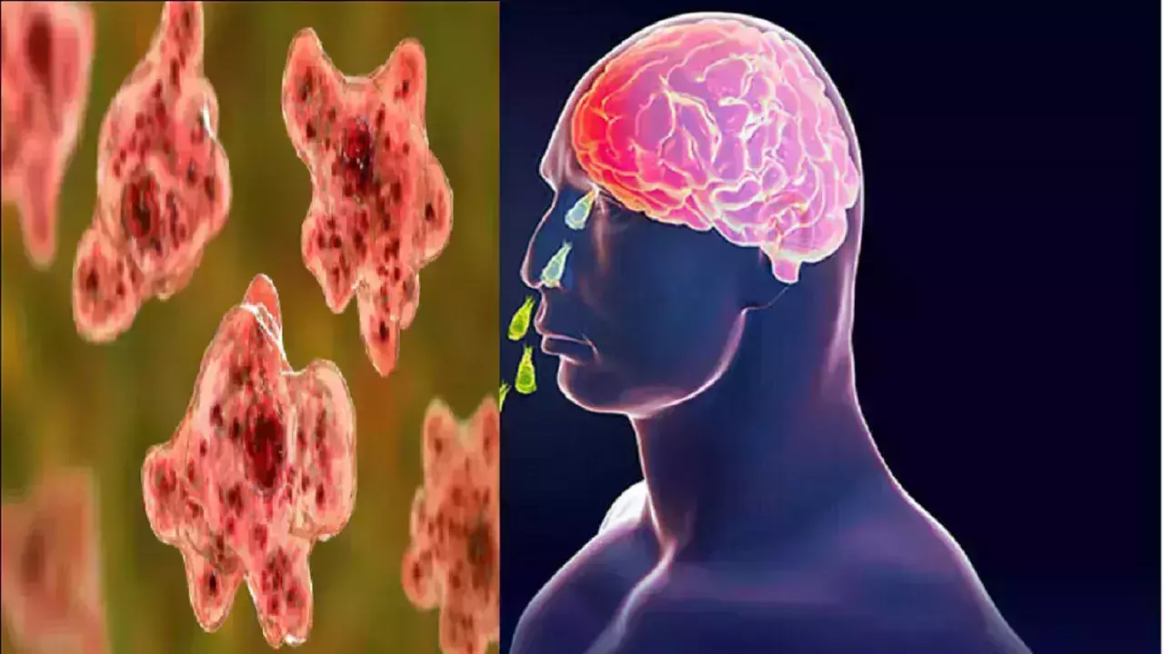 അമീബിക് മസ്തിഷ്‌കജ്വരത്തെ കീഴടക്കി 12-കാരന്‍; കേരളത്തില്‍ തുടര്‍ച്ചയായി രോഗമുക്തി നേടുന്നത് രണ്ടുപേര്‍