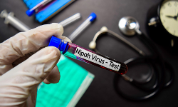 പാണ്ടിക്കാട് നിന്നെടുത്ത വവ്വാല് സാമ്പിളില് വൈറസിന്റെ ആന്റിബോഡി സാന്നിധ്യം പാണ്ടിക്കാട് നിന്നെടുത്ത വവ്വാല് സാമ്പിളില് വൈറസിന്റെ ആന്റിബോഡി സാന്നിധ്യം