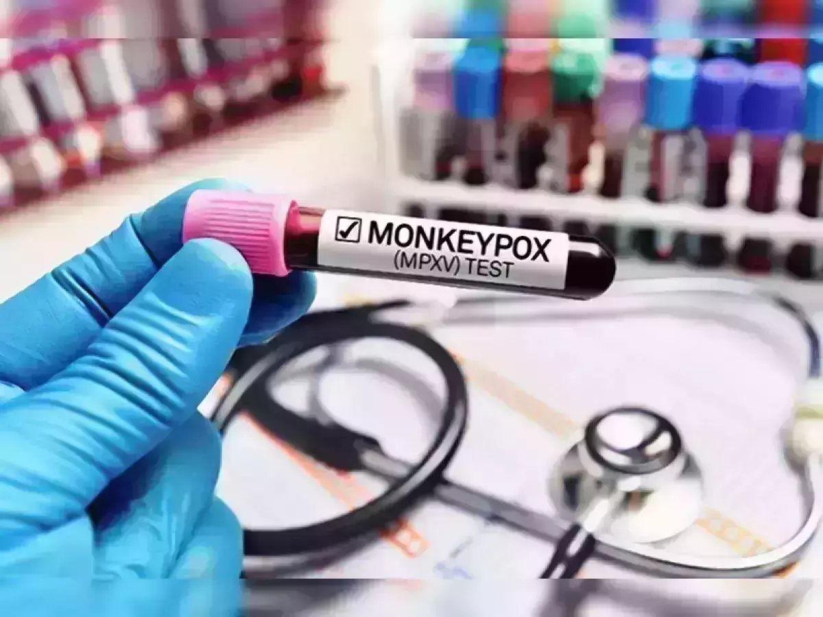 കുരങ്ങുപനിയെന്ന് സംശയം; വിദേശയാത്ര കഴിഞ്ഞ് മടങ്ങിയെത്തിയയാളെ ഡല്‍ഹി എയിംസില്‍ പ്രവേശിപ്പിച്ചു