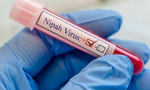 നിപ ബാധിച്ച് മരിച്ച യുവാവ് നാല് ആശുപത്രികളില് ചികിത്സതേടി; പ്രാഥമിക സമ്പര്ക്കപ്പട്ടികയില് ഉള്ളത് 151 പേര് നിപ ബാധിച്ച് മരിച്ച യുവാവ് നാല് ആശുപത്രികളില് ചികിത്സതേടി; പ്രാഥമിക സമ്പര്ക്കപ്പട്ടികയില് ഉള്ളത് 151 പേര്