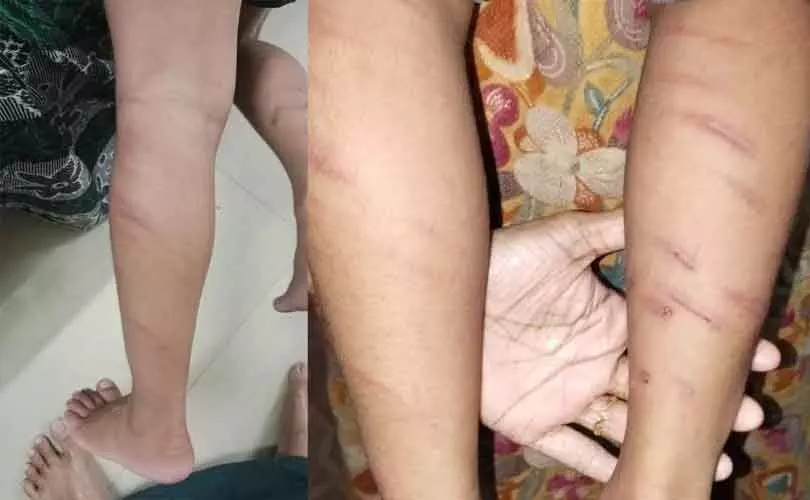 യുകെജി വിദ്യാര്‍ത്ഥിയെ ക്രൂരമായി മര്‍ദ്ദിച്ച് ഒളിവില്‍ പോയ അധ്യാപികയെ കണ്ടെത്താനായില്ല