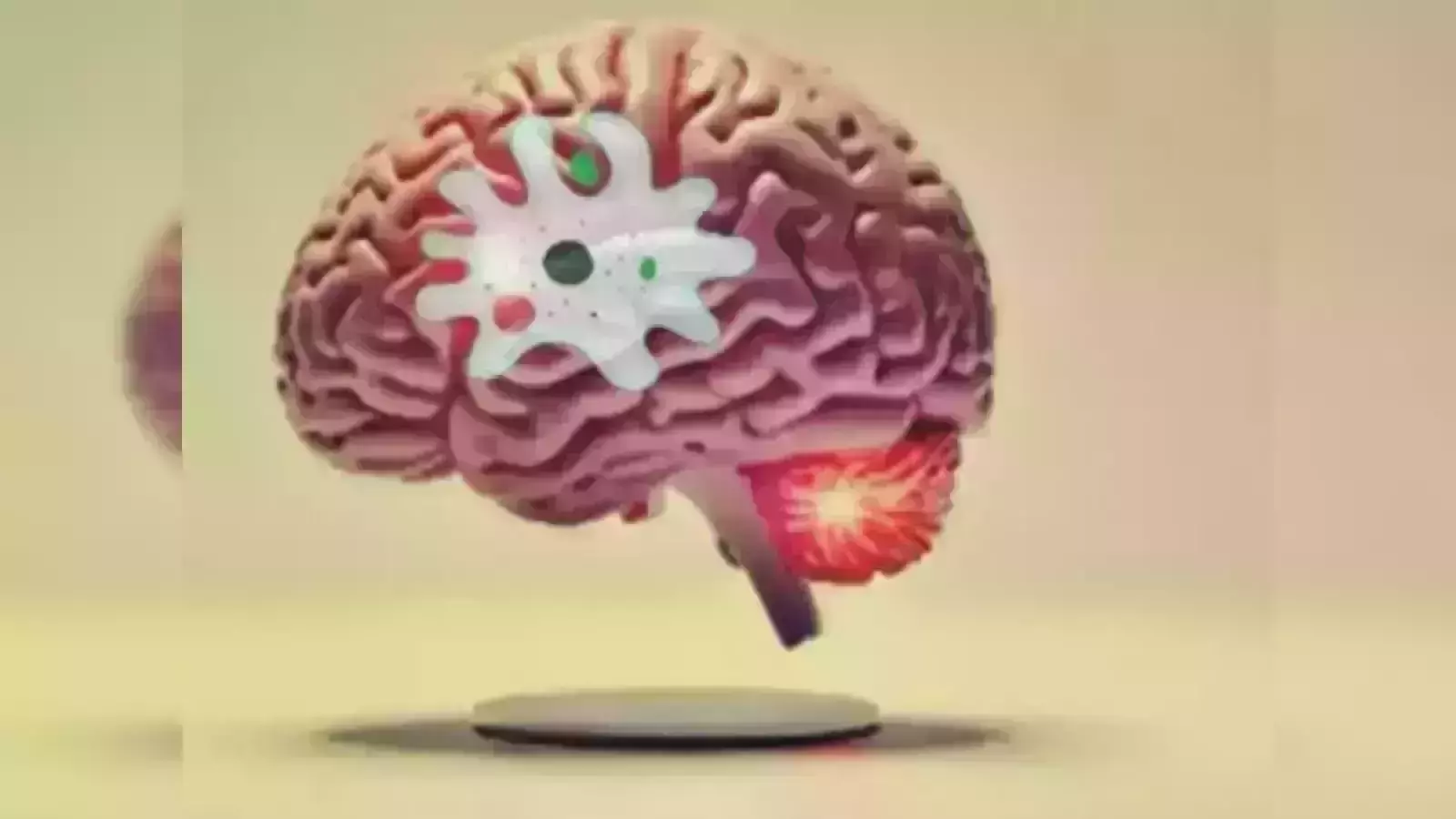 പത്തനാപുരത്ത് വീണ്ടും അമീബിക് മസ്തിഷ്‌ക ജ്വരം; ആറു വയസുകാരന്‍ ഗുരുതരാവസ്ഥയില്‍