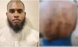 കണ്ണൂരില്‍ വിദ്യാര്‍ഥിയെ ഇസ്തിരിപ്പെട്ടി കൊണ്ട് പൊള്ളിച്ച കേസില്‍ അധ്യാപകന്‍ അറസ്റ്റില്‍