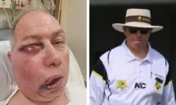 സ്ട്രെയ്റ്റ് ഡ്രൈവില് പന്ത് മുഖത്തടിച്ചു; അംപയര് ടോണി ഡെ നൊബ്രെഗയ്ക്ക് ഗുരുതര പരിക്ക് സ്ട്രെയ്റ്റ് ഡ്രൈവില് പന്ത് മുഖത്തടിച്ചു; അംപയര് ടോണി ഡെ നൊബ്രെഗയ്ക്ക് ഗുരുതര പരിക്ക്