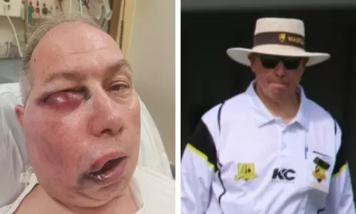 സ്ട്രെയ്റ്റ് ഡ്രൈവില് പന്ത് മുഖത്തടിച്ചു; അംപയര് ടോണി ഡെ നൊബ്രെഗയ്ക്ക് ഗുരുതര പരിക്ക് സ്ട്രെയ്റ്റ് ഡ്രൈവില് പന്ത് മുഖത്തടിച്ചു; അംപയര് ടോണി ഡെ നൊബ്രെഗയ്ക്ക് ഗുരുതര പരിക്ക്