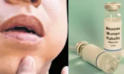 เดธเดเดธเตเดฅเดพเดจเดคเตเดคเต เดฎเตเดฃเตเดเดฟเดจเตเดฐเต เดฌเดพเดงเดฟเดคเดฐเตโ 70,000 เดเดเดจเตเดจเต; เดเดเดเดเดเดฐเตโ เดตเดพเดเตเดธเตเดจเตโ เดเดตเดถเตเดฏเดชเตเดชเตเดเตเดเต เดเตเดฐเดณเด เดธเดเดธเตเดฅเดพเดจเดคเตเดคเต เดฎเตเดฃเตเดเดฟเดจเตเดฐเต เดฌเดพเดงเดฟเดคเดฐเตโ 70,000 เดเดเดจเตเดจเต; เดเดเดเดเดเดฐเตโ เดตเดพเดเตเดธเตเดจเตโ เดเดตเดถเตเดฏเดชเตเดชเตเดเตเดเต เดเตเดฐเดณเด