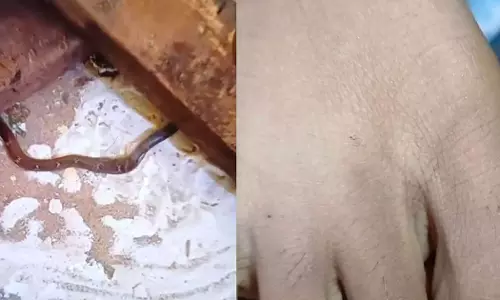 വിദ്യാര്‍ഥിനിക്ക് പാമ്പുകടിയേറ്റ സംഭവം; റിപോര്‍ട്ട് തേടി വിദ്യാഭ്യാസമന്ത്രി