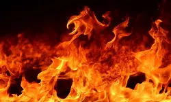 നിര്‍ത്തിയിട്ട സ്‌കൂട്ടറിന് തീപിടിച്ച് 6 വയസ്സുകാരന് പൊള്ളലേറ്റു