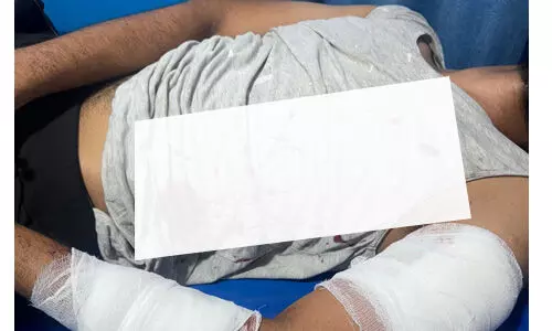 കാസര്കോട് മീപ്പുഗിരിയില് യുവാവിന് കുത്തേറ്റു കാസര്കോട് മീപ്പുഗിരിയില് യുവാവിന് കുത്തേറ്റു