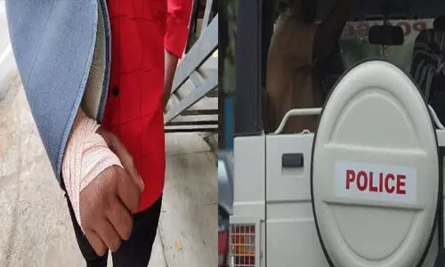 പതിനാലുകാരന്റെ കൈ പോലിസ് ഉദ്യോഗസ്ഥന്‍ ഒടിച്ചതായി ആരോപണം