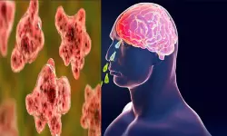 കോഴിക്കോട്ട് സ്വദേശിനിക്ക് അമീബിക് മസ്തിഷ്‌ക ജ്വരം സ്ഥിരീകരിച്ചു