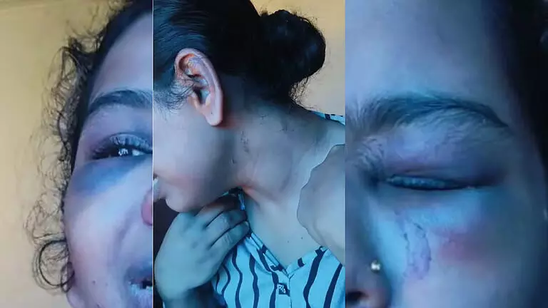 യുവതിയെ വീട്ടില്‍ പൂട്ടിയിട്ടു, കഴുത്തില്‍ ബെല്‍റ്റിട്ട് മുറുക്കി ക്രൂര മര്‍ദനം; ഭര്‍ത്താവിനും മാതാവിനുമെതിരെ കേസ്