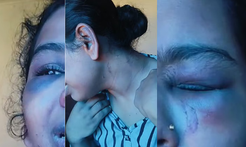 യുവതിയെ വീട്ടില്‍ പൂട്ടിയിട്ടു, കഴുത്തില്‍ ബെല്‍റ്റിട്ട് മുറുക്കി ക്രൂര മര്‍ദനം; ഭര്‍ത്താവിനും മാതാവിനുമെതിരെ കേസ്