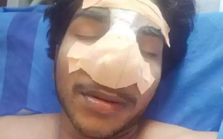 സഹപാഠിയുടെ മർദനമേറ്റ് വിദ്യാർഥിയുടെ മൂക്കിന് പരിക്ക്