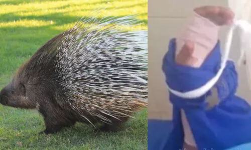 മുള്ളന്പന്നിയുടെ ആക്രമണത്തില് വിദ്യാര്ഥിക്ക് പരിക്ക് മുള്ളന്പന്നിയുടെ ആക്രമണത്തില് വിദ്യാര്ഥിക്ക് പരിക്ക്