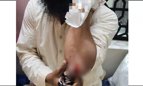 ഖുര്‍ആന്‍ അധ്യാപകനെ ഹിന്ദുത്വര്‍ ആക്രമിച്ചു