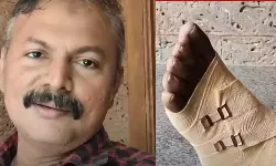 ലഹരി ഇടപാട് നടത്തിയവരെ പിടി കൂടാന്‍ ശ്രമിച്ച പോലിസിനെ കാറിടിച്ചു കൊല്ലാന്‍ ശ്രമം