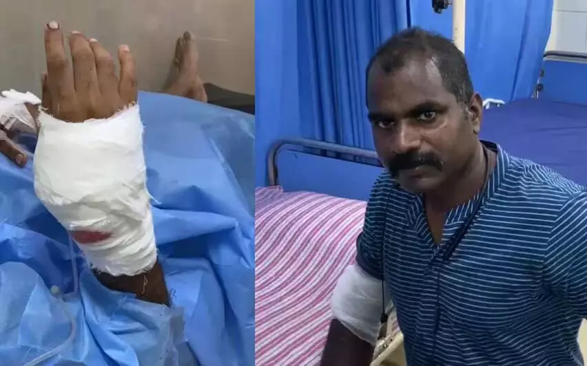 കോഴിക്കോട് കാര് മോഷണക്കേസ് പ്രതിയെ പിടിക്കാനെത്തിയ പോലിസുകാര്ക്ക് വെട്ടേറ്റു കോഴിക്കോട് കാര് മോഷണക്കേസ് പ്രതിയെ പിടിക്കാനെത്തിയ പോലിസുകാര്ക്ക് വെട്ടേറ്റു