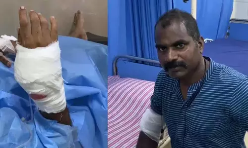 കോഴിക്കോട് കാര് മോഷണക്കേസ് പ്രതിയെ പിടിക്കാനെത്തിയ പോലിസുകാര്ക്ക് വെട്ടേറ്റു കോഴിക്കോട് കാര് മോഷണക്കേസ് പ്രതിയെ പിടിക്കാനെത്തിയ പോലിസുകാര്ക്ക് വെട്ടേറ്റു