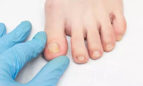 മുടി കൊഴിച്ചിലിനു പിറകെ, നഖം പൊഴിഞ്ഞു പോകല്‍; വീണ്ടും ആശങ്കയില്‍ മഹാരാഷ്ട്രയിലെ ബുല്‍ദാന