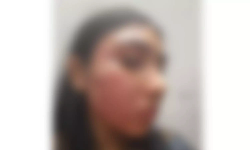 ജൂനിയര് അഭിഭാഷകയെ സീനിയര് അഭിഭാഷകന് ക്രൂരമായി മര്ദ്ദിച്ചതായി പരാതി ജൂനിയര് അഭിഭാഷകയെ സീനിയര് അഭിഭാഷകന് ക്രൂരമായി മര്ദ്ദിച്ചതായി പരാതി