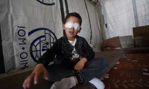 ഗസക്കെതിരായ ഇസ്രായേലിന്റെ വംശഹത്യ; ഇതുവരെ കാഴ്ച ശക്തി നഷ്ടപ്പെട്ടത് 1,500 ഫലസ്തീനികള്‍ക്ക്