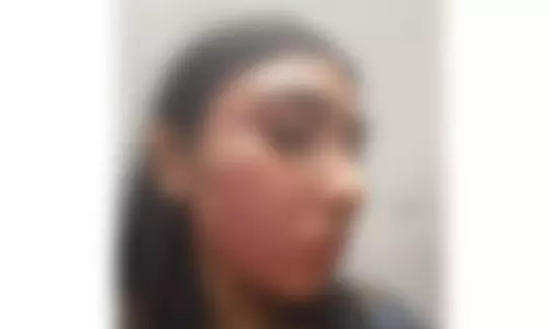 ജൂനിയര്‍ അഭിഭാഷകയെ സീനിയര്‍ അഭിഭാഷകന്‍ ക്രൂരമായി മര്‍ദ്ദിച്ചതായി പരാതി