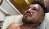 അഹ്മ്മദാബാദ് വിമാന അപകടം: ഒരാള്‍ രക്ഷപ്പെട്ടു (വീഡിയോ)