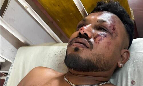 അഹ്മ്മദാബാദ് വിമാന അപകടം: ഒരാള്‍ രക്ഷപ്പെട്ടു (വീഡിയോ)