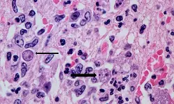 സംസ്ഥാനത്ത് ഒരാള്‍ക്ക് കൂടി അമീബിക് മസ്തിഷ്‌ക ജ്വരം