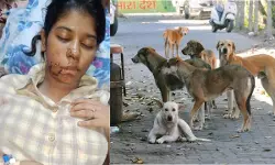 ഉത്തര്പ്രദേശില് 21കാരിയെ കടിച്ചുകീറി തെരുവുനായ; കവിള് രണ്ടായി മുറിഞ്ഞു; മുഖത്ത് 17 തുന്നലുകള് ഉത്തര്പ്രദേശില് 21കാരിയെ കടിച്ചുകീറി തെരുവുനായ; കവിള് രണ്ടായി മുറിഞ്ഞു; മുഖത്ത് 17 തുന്നലുകള്