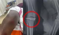 എസ്എഫ്ഐ നേതാവിന് കുത്തേറ്റു; സംഭവം കണ്ണൂരില് എസ്എഫ്ഐ നേതാവിന് കുത്തേറ്റു; സംഭവം കണ്ണൂരില്