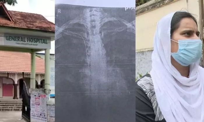 തിരുവനന്തപുരം ജനറല്‍ ആശുപത്രിയില്‍ ശസ്ത്രക്രിയ പിഴവ്; യുവതിയുടെ നെഞ്ചിനകത്ത് 50 സെന്റിമീറ്റര്‍ നീളമുള്ള വയര്‍ കുടുങ്ങി