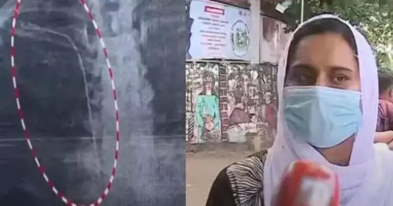 തിരുവനന്തപുരം ജനറല് ആശുപത്രിയിലെ ചികില്സാ പിഴവ്; ഡോക്ടര്ക്കെതിരേ കേസ് തിരുവനന്തപുരം ജനറല് ആശുപത്രിയിലെ ചികില്സാ പിഴവ്; ഡോക്ടര്ക്കെതിരേ കേസ്