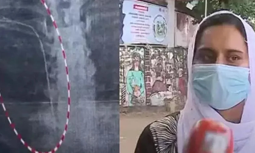 തിരുവനന്തപുരം ജനറല് ആശുപത്രിയിലെ ചികില്സാ പിഴവ്; ഡോക്ടര്ക്കെതിരേ കേസ് തിരുവനന്തപുരം ജനറല് ആശുപത്രിയിലെ ചികില്സാ പിഴവ്; ഡോക്ടര്ക്കെതിരേ കേസ്