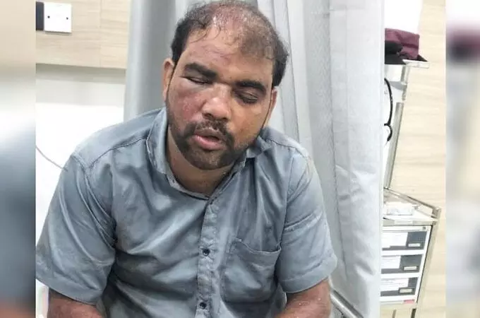 ടിടിഇ ടിക്കറ്റും തിരിച്ചറിയല് രേഖകളും ആവശ്യപ്പെട്ടു; താനൂരില് ഓടുന്ന ട്രെയിനില് നിന്ന് താഴേക്ക് ചാടിയ ശീതളപാനീയ കച്ചവടക്കാരന് പരിക്ക് ടിടിഇ ടിക്കറ്റും തിരിച്ചറിയല് രേഖകളും ആവശ്യപ്പെട്ടു; താനൂരില് ഓടുന്ന ട്രെയിനില് നിന്ന് താഴേക്ക് ചാടിയ ശീതളപാനീയ കച്ചവടക്കാരന് പരിക്ക്