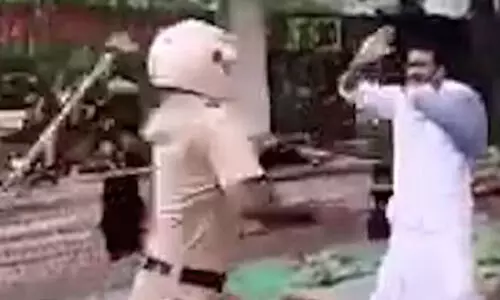 ഒടിഞ്ഞ കൈയ്യുമായി ബസ് കാത്തുനില്‍ക്കുമ്പോള്‍ പോലിസ് ആക്രമിച്ചു; നടപടി വേണമെന്ന് മനുഷ്യാവകാശ കമ്മീഷന്‍