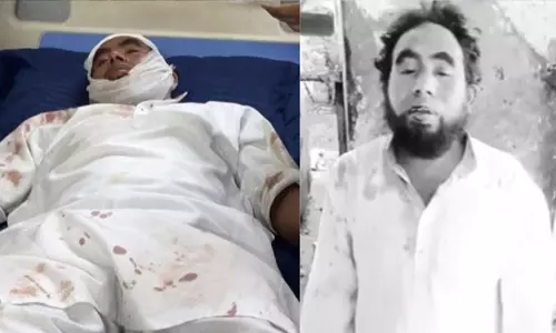 അലീഗഡില് ഇമാമിന് നേരെ ആക്രമണം അലീഗഡില് ഇമാമിന് നേരെ ആക്രമണം