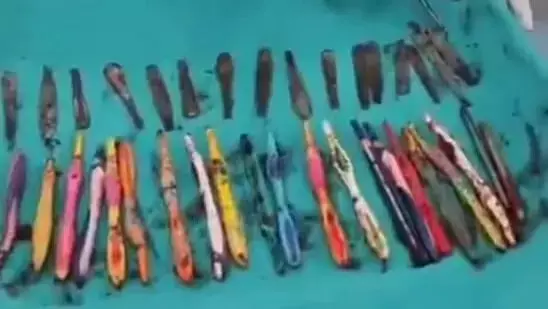 35കാരന്റെ വയറ്റില് നിന്ന് പുറത്തെടുത്തത് 29 സ്റ്റീല് സ്പൂണുകളും 19 ടൂത്ത് ബ്രഷുകളും 35കാരന്റെ വയറ്റില് നിന്ന് പുറത്തെടുത്തത് 29 സ്റ്റീല് സ്പൂണുകളും 19 ടൂത്ത് ബ്രഷുകളും